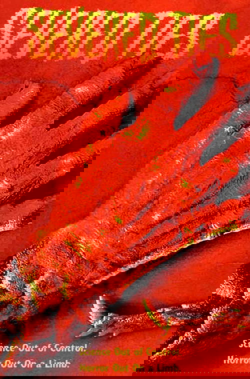 Severed Ties